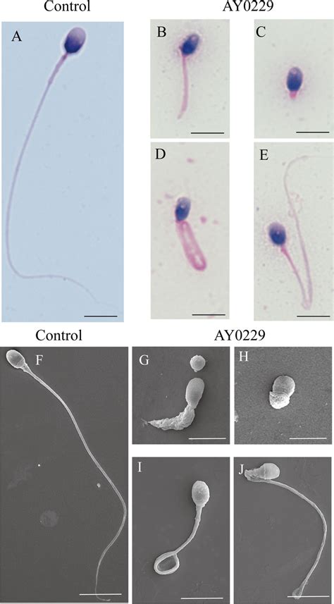 Morphology Of Spermatozoa In A Patient Carrying A Dnah10 Variant A E Download Scientific