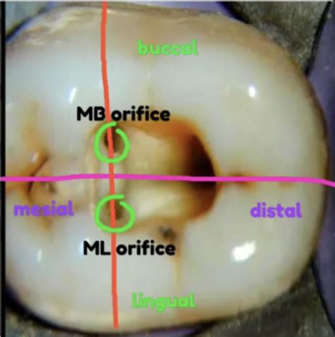 lesson  internal anatomy flashcards quizlet