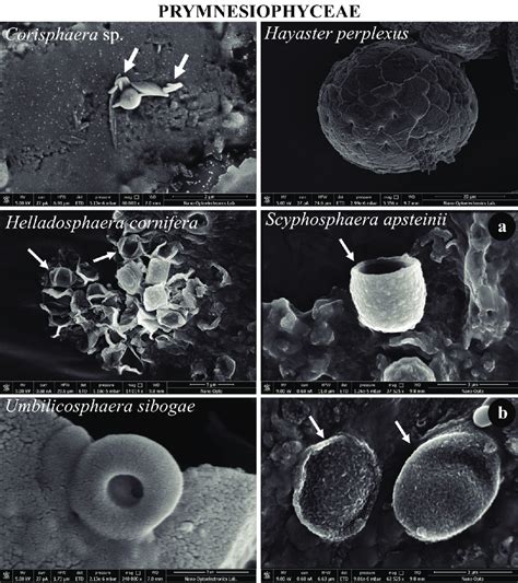 The Images Of New Record Prymnesiophyceae Species Were Taken With The