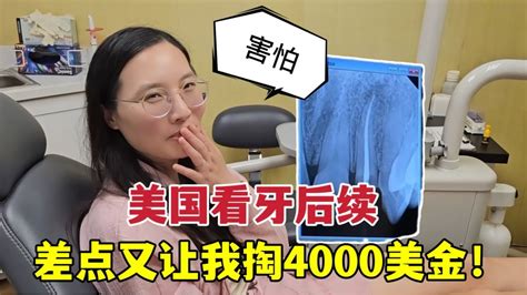 在美國看牙有陰影，醫生讓拔牙搭橋收4千美金：為啥我沒同意？ Youtube