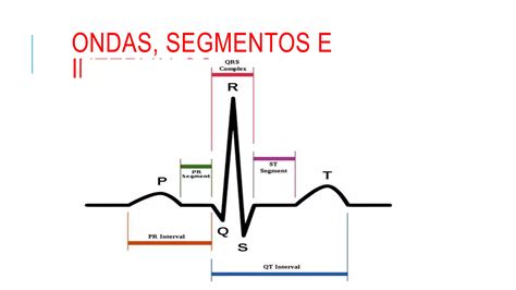 RITMOS ELECTROCARDIOGRAMA PPT Descarga Gratuita