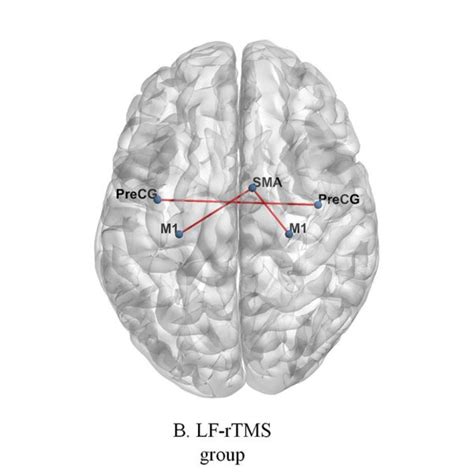 Figure Significant Functional Connectivity Changes After Rtms The Red