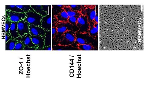 Human Brain Microvascular Endothelial Cells Angio Proteomie