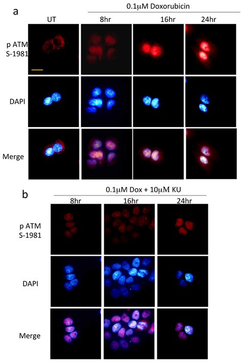 Double Stranded Dna Damage Induces Time Dependent Nuclear Induction Of