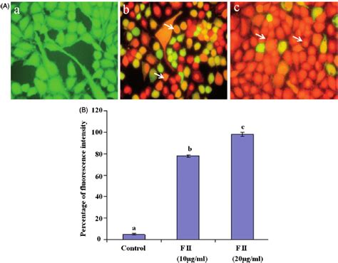 A Fluorescence Microphotograph Showed Apoptotic Morphological Changes