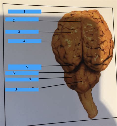 Sheep Brain Frontal View Diagram Quizlet