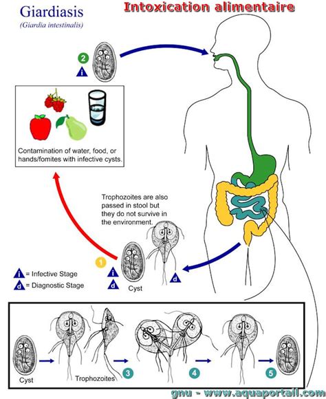 Intoxication alimentaire définition et explications