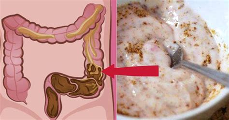 Depurare Il Colon In Maniera Naturale In Soli 5 Giorni Con Rimedi Efficaci