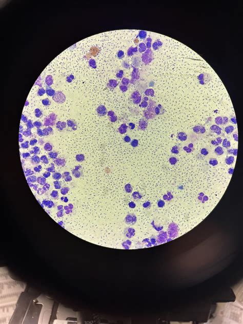 Pleural fluid : r/medlabprofessionals