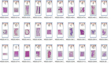 High-resolution scan copies of pathology slides, digital pathology slides