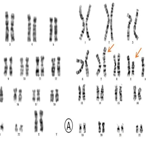 The Results Of Cnv Seq Analysis A The Whole Genome View B The