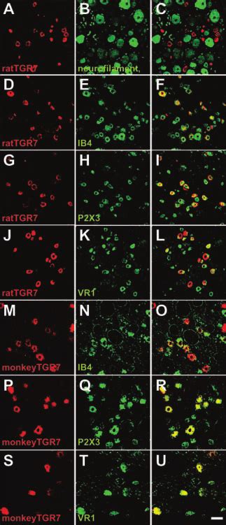 Expression Pattern Of Tgr7 In The Rat And Monkey Drg Neurons