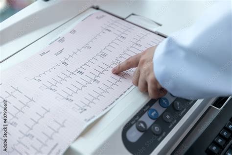 Doctor holding a cardiogram test. Doctor with electrocardiogram ...