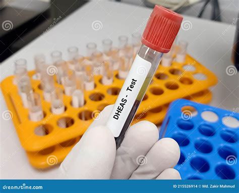 Test Tube With Blood Sample For DHEAS Dehydroepiandrosterone Sulfate