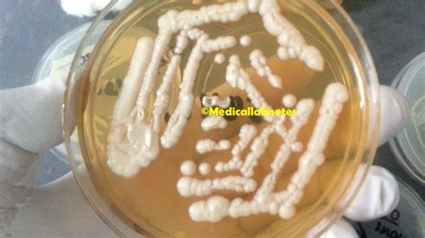 Candida Krusei Introduction Morphology Pathogenicity Lab