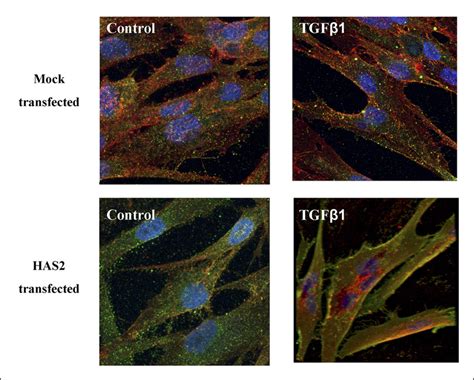 Effect Of Has Overexpression On Cd And Egfr Co Localization In Oral