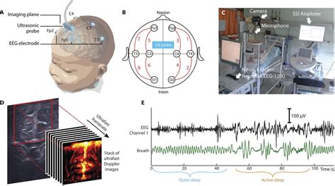 Functional Ultrasound Imaging Of Brain Activity In Human Newborns