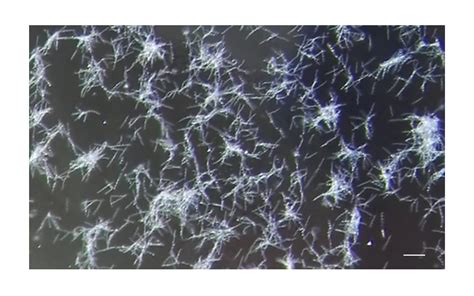 Cultivation Methods of Spirochetes from Borrelia burgdorferi Sensu Lato ...