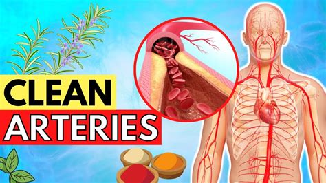 Top 5 Spices To Clean Your Arteries That Can Prevent A Heart Attack