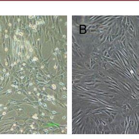 Morphology of bone marrow mesenchymal stem cells cultured in vitro ...