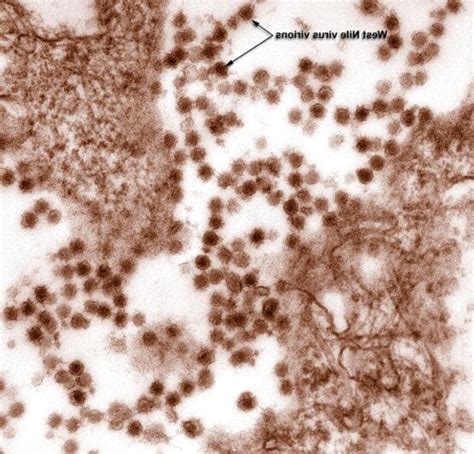 Free Picture Micrograph West Nile Virus