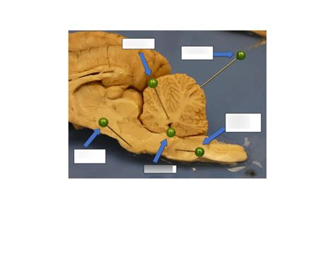 Sheep Brain Dissection Pt5 Diagram Quizlet