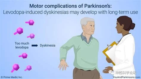 帕金森病：左旋多巴引起的运动障碍（levodopa Induced Dyskinesia，lid） Medsci Cn