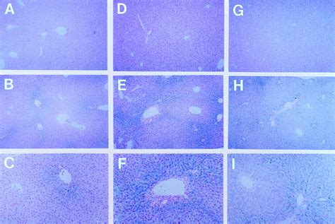 Mouse Strain Differences Determine Severity Of Iron Accumulation In Hfe