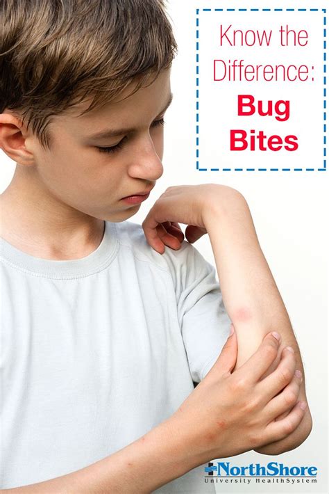 What Bit Me If Youre Not Sure Take A Look At These Tips For Identifying Bug Bites From