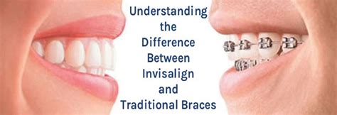 Understanding The Difference Between Invisalign And Traditional Braces