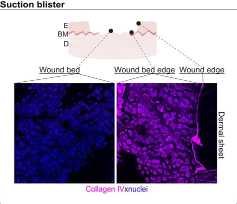 Epidermal Dermal Separation Techniques And Analysis Of Cell Populations