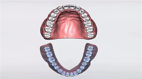 3shape Implant Studio Edentulous Case 1how To Create Order And