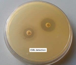 Esbl Introduction Detection Methods And Treatment Option