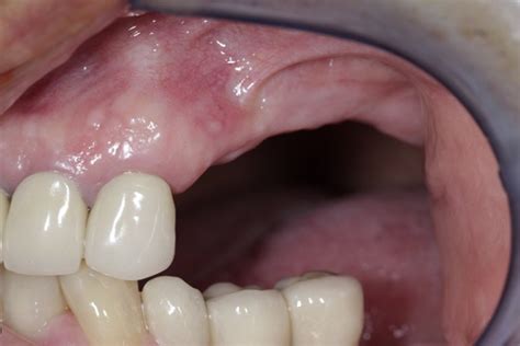 Periodoncia Especialistas en Implantología