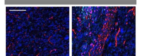 Publication Alert - Reprogramming the Intrahepatic Cholangiocarcinoma Immune Microenvironment ...