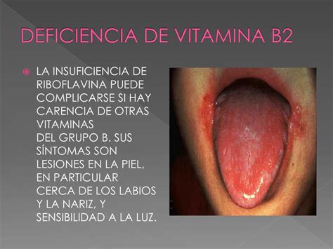 Ppt Vitaminas Powerpoint Presentation Free Download Id 2146881