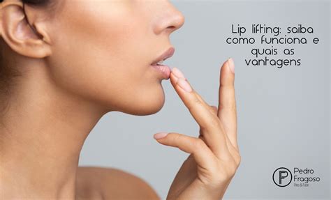 Lip Lifting Saiba Como Funciona E Quais As Vantagens Dr Pedro Fragoso