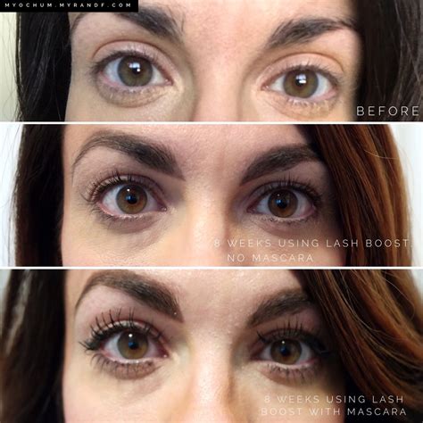 My Honest Review Of Rodan Fields Lash Boost