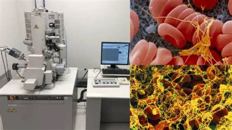 Scanning Electron Microscope - Principle, Parts, Uses - Biology Notes ... 