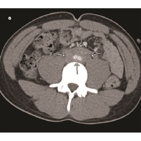 Initial imaging studies. Left: renal ultrasound at presentation ...