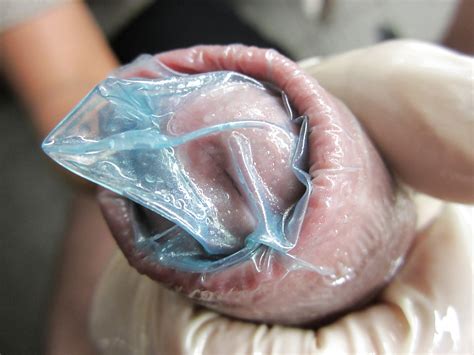 Alles Mit Condom 10 Porn Pictures XXX Photos Sex Images 1214420 PICTOA