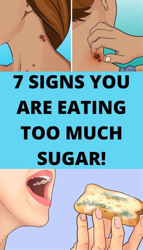 Signs You Are Eating Too Much Sugar Artofit