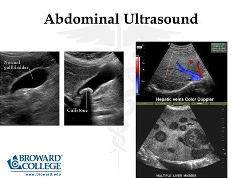 Ppt Diagnostic Medical Sonography Powerpoint Presentation Free