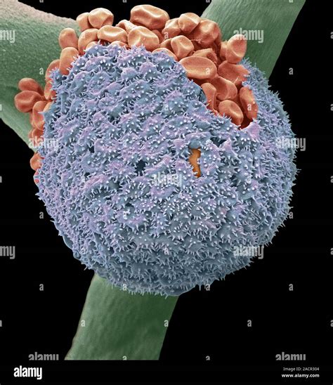 Bread Mould Coloured Scanning Electron Micrograph Sem Of A Black