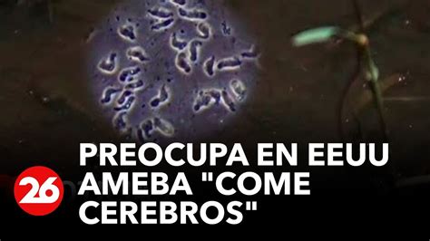 Preocupa En Estados Unidos Ameba Come Cerebros Se Encuentra En El