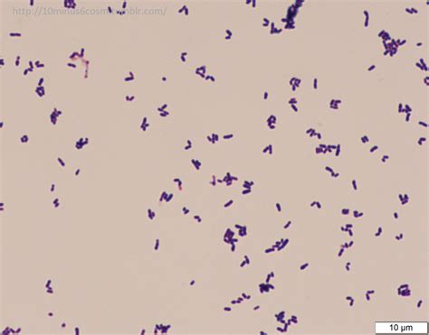 Corynebacterium Gram Stain