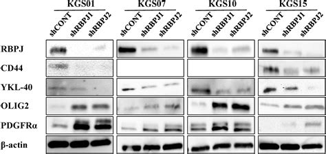 Rbpj Contributes To The Malignancy Of Glioblastoma And Induction Of