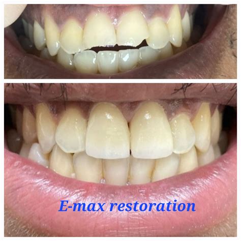 Liberty Dental Clinic | Tijuana