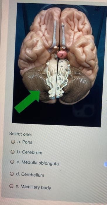 Solved Be Select One O A Thalamus O B Anterior Commissure Chegg