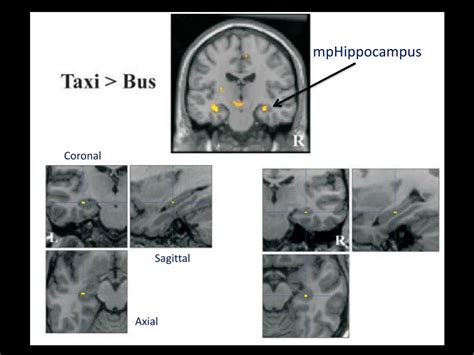 PPT - London Taxi Drivers and Bus Drivers: A Structural MRI and ...